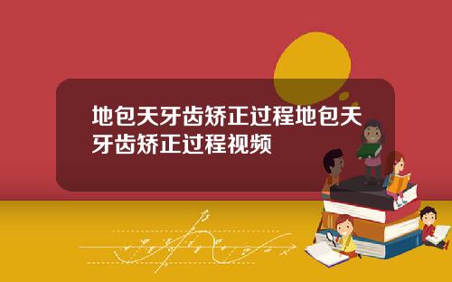 地包天牙齿矫正过程地包天牙齿矫正过程视频