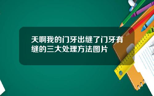 天啊我的门牙出缝了门牙有缝的三大处理方法图片
