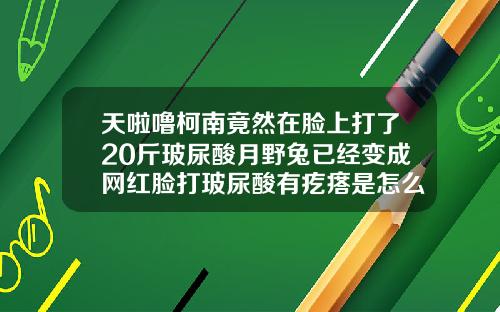 天啦噜柯南竟然在脸上打了20斤玻尿酸月野兔已经变成网红脸打玻尿酸有疙瘩是怎么回事