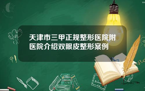 天津市三甲正规整形医院附医院介绍双眼皮整形案例
