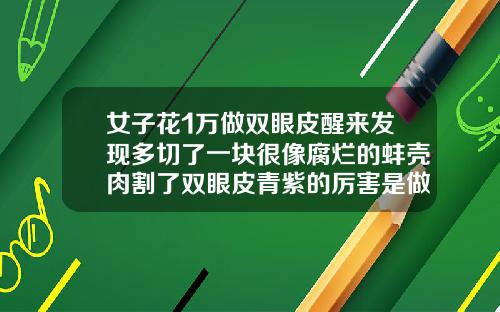 女子花1万做双眼皮醒来发现多切了一块很像腐烂的蚌壳肉割了双眼皮青紫的厉害是做坏了吗
