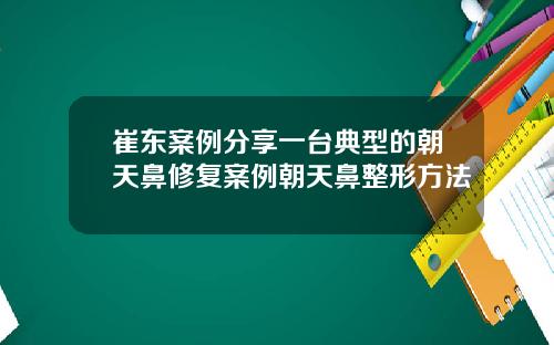 崔东案例分享一台典型的朝天鼻修复案例朝天鼻整形方法
