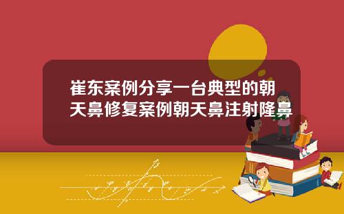 崔东案例分享一台典型的朝天鼻修复案例朝天鼻注射隆鼻