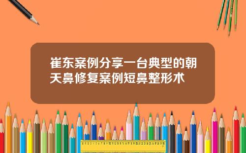 崔东案例分享一台典型的朝天鼻修复案例短鼻整形术