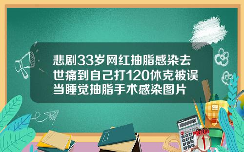 悲剧33岁网红抽脂感染去世痛到自己打120休克被误当睡觉抽脂手术感染图片