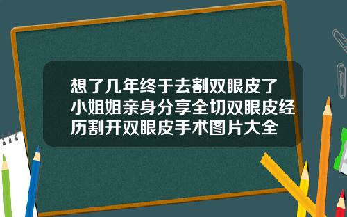 想了几年终于去割双眼皮了小姐姐亲身分享全切双眼皮经历割开双眼皮手术图片大全