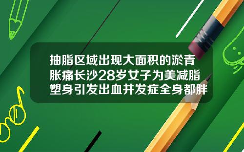 抽脂区域出现大面积的淤青胀痛长沙28岁女子为美减脂塑身引发出血并发症全身都胖吸脂