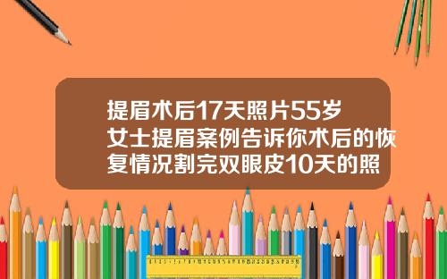 提眉术后17天照片55岁女士提眉案例告诉你术后的恢复情况割完双眼皮10天的照片
