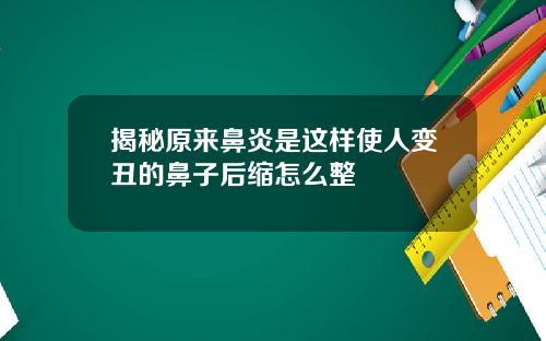 揭秘原来鼻炎是这样使人变丑的鼻子后缩怎么整
