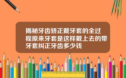 揭秘牙齿矫正戴牙套的全过程原来牙套是这样戴上去的带牙套纠正牙齿多少钱