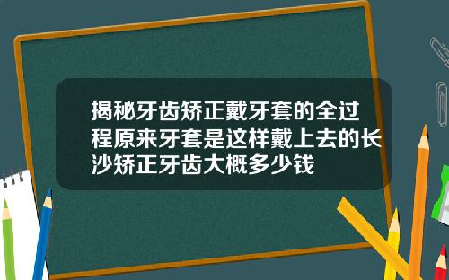 揭秘牙齿矫正戴牙套的全过程原来牙套是这样戴上去的长沙矫正牙齿大概多少钱