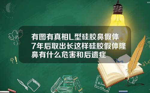 有图有真相L型硅胶鼻假体7年后取出长这样硅胶假体隆鼻有什么危害和后遗症