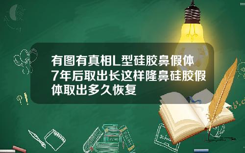 有图有真相L型硅胶鼻假体7年后取出长这样隆鼻硅胶假体取出多久恢复