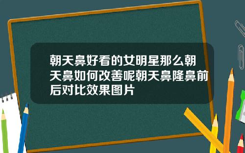 朝天鼻好看的女明星那么朝天鼻如何改善呢朝天鼻隆鼻前后对比效果图片