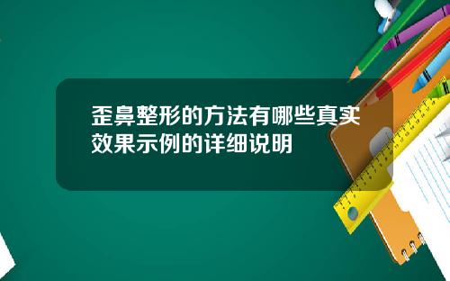 歪鼻整形的方法有哪些真实效果示例的详细说明