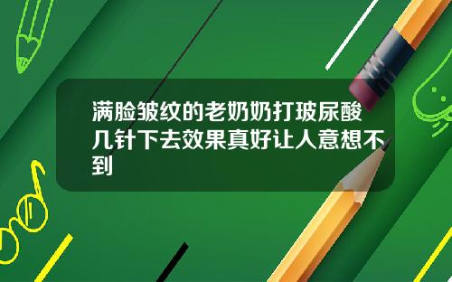 满脸皱纹的老奶奶打玻尿酸几针下去效果真好让人意想不到