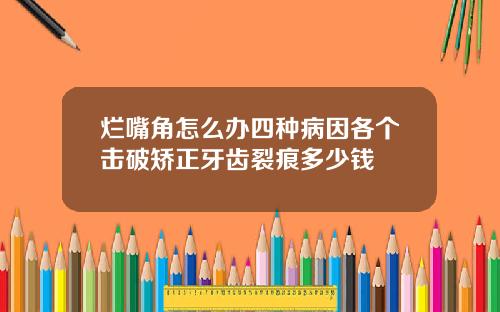 烂嘴角怎么办四种病因各个击破矫正牙齿裂痕多少钱