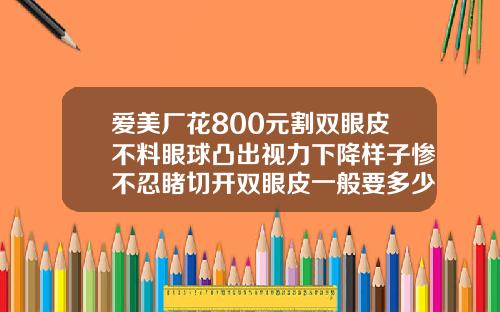 爱美厂花800元割双眼皮不料眼球凸出视力下降样子惨不忍睹切开双眼皮一般要多少钱