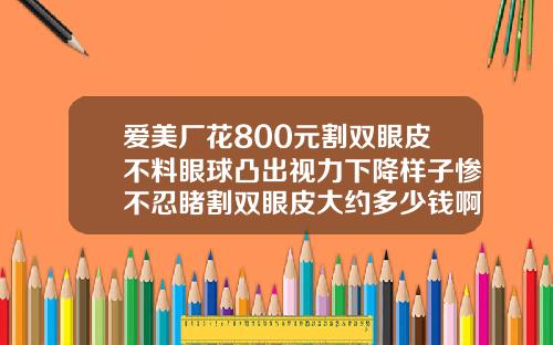 爱美厂花800元割双眼皮不料眼球凸出视力下降样子惨不忍睹割双眼皮大约多少钱啊一次