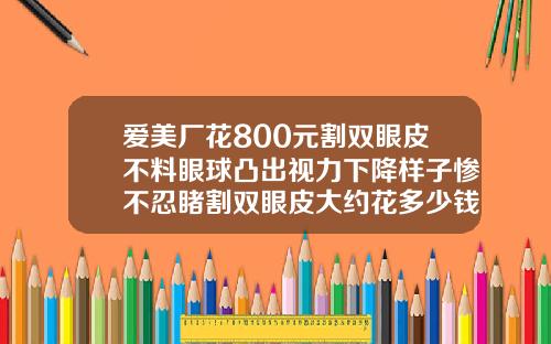 爱美厂花800元割双眼皮不料眼球凸出视力下降样子惨不忍睹割双眼皮大约花多少钱一次