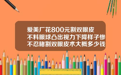 爱美厂花800元割双眼皮不料眼球凸出视力下降样子惨不忍睹割双眼皮术大概多少钱