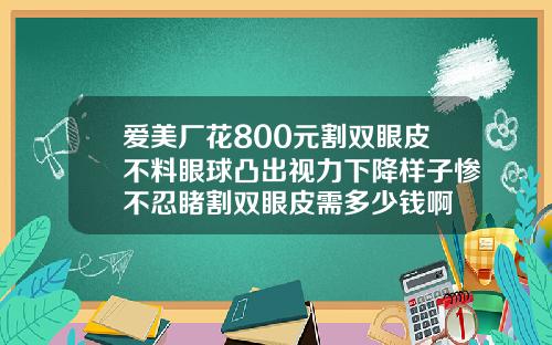 爱美厂花800元割双眼皮不料眼球凸出视力下降样子惨不忍睹割双眼皮需多少钱啊