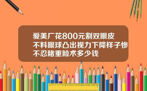 爱美厂花800元割双眼皮不料眼球凸出视力下降样子惨不忍睹重睑术多少钱