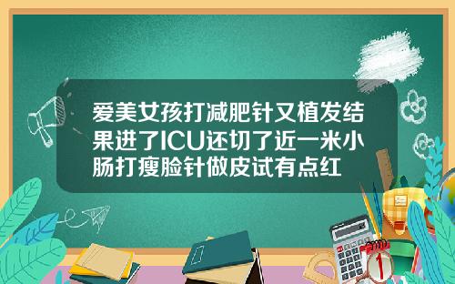 爱美女孩打减肥针又植发结果进了ICU还切了近一米小肠打瘦脸针做皮试有点红