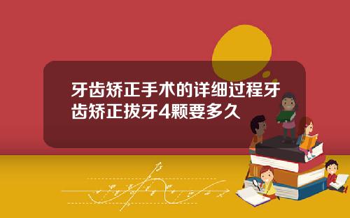 牙齿矫正手术的详细过程牙齿矫正拔牙4颗要多久