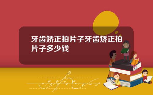 牙齿矫正拍片子牙齿矫正拍片子多少钱
