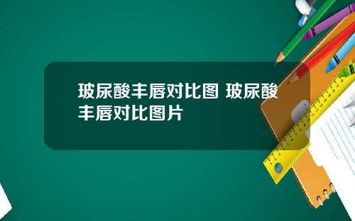 玻尿酸丰唇对比图 玻尿酸丰唇对比图片