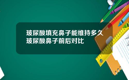 玻尿酸填充鼻子能维持多久玻尿酸鼻子前后对比