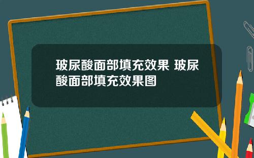 玻尿酸面部填充效果 玻尿酸面部填充效果图