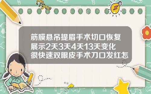 筋膜悬吊提眉手术切口恢复展示2天3天4天13天变化很快速双眼皮手术刀口发红怎么回事