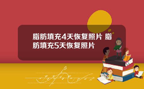 脂肪填充4天恢复照片 脂肪填充5天恢复照片