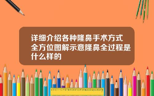 详细介绍各种隆鼻手术方式全方位图解示意隆鼻全过程是什么样的