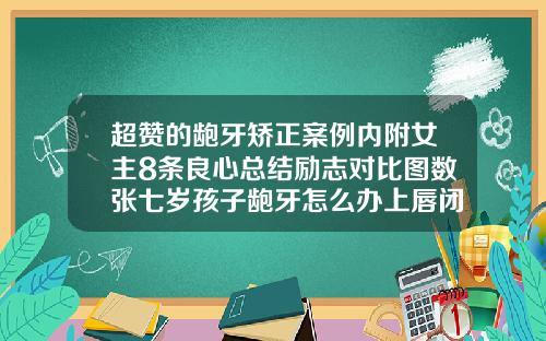 超赞的龅牙矫正案例内附女主8条良心总结励志对比图数张七岁孩子龅牙怎么办上唇闭不上
