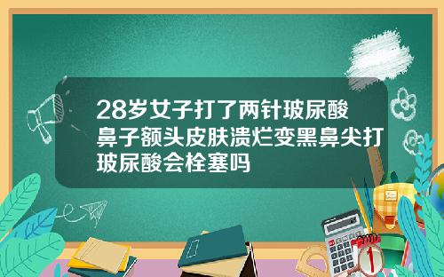 28岁女子打了两针玻尿酸鼻子额头皮肤溃烂变黑鼻尖打玻尿酸会栓塞吗