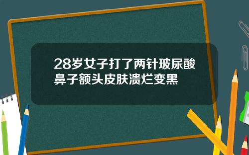 28岁女子打了两针玻尿酸鼻子额头皮肤溃烂变黑