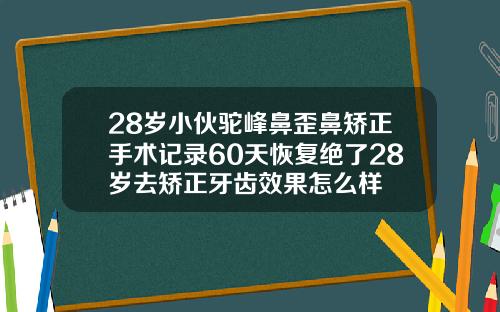 28岁小伙驼峰鼻歪鼻矫正手术记录60天恢复绝了28岁去矫正牙齿效果怎么样