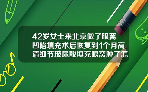 42岁女士来北京做了眼窝凹陷填充术后恢复到1个月高清细节玻尿酸填充眼窝肿了怎么办
