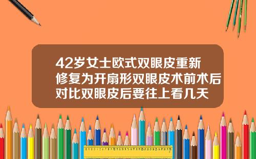 42岁女士欧式双眼皮重新修复为开扇形双眼皮术前术后对比双眼皮后要往上看几天