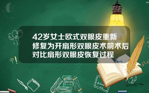 42岁女士欧式双眼皮重新修复为开扇形双眼皮术前术后对比扇形双眼皮恢复过程