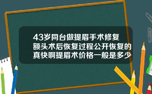 43岁同台做提眉手术修复额头术后恢复过程公开恢复的真快啊提眉术价格一般是多少手术