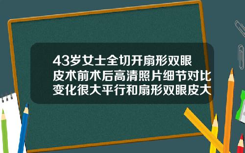 43岁女士全切开扇形双眼皮术前术后高清照片细节对比变化很大平行和扇形双眼皮大概多少钱