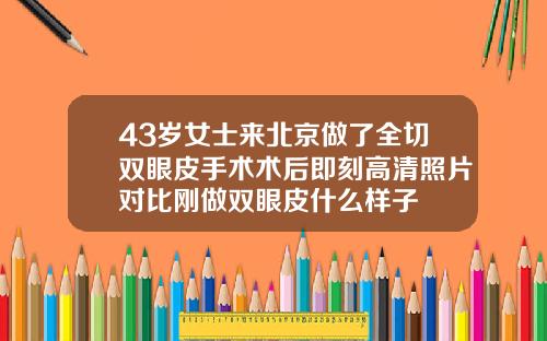 43岁女士来北京做了全切双眼皮手术术后即刻高清照片对比刚做双眼皮什么样子