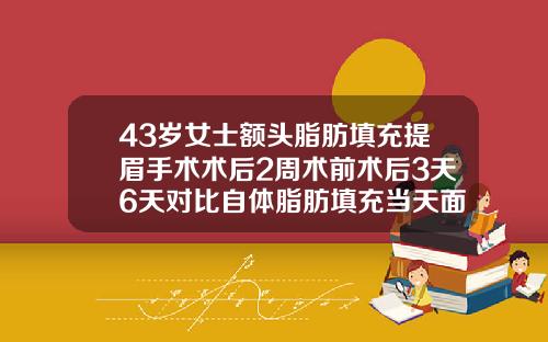 43岁女士额头脂肪填充提眉手术术后2周术前术后3天6天对比自体脂肪填充当天面诊就能做吗