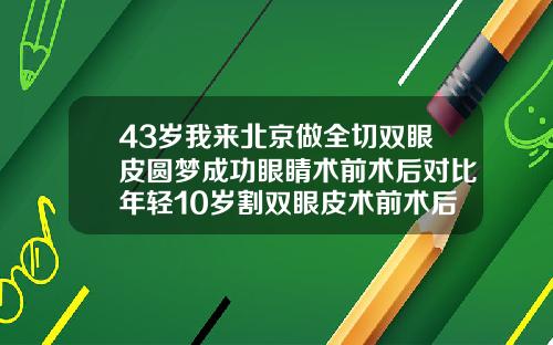 43岁我来北京做全切双眼皮圆梦成功眼睛术前术后对比年轻10岁割双眼皮术前术后