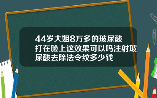 44岁大姐8万多的玻尿酸打在脸上这效果可以吗注射玻尿酸去除法令纹多少钱