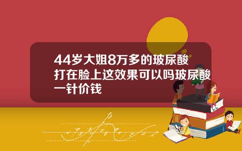 44岁大姐8万多的玻尿酸打在脸上这效果可以吗玻尿酸一针价钱